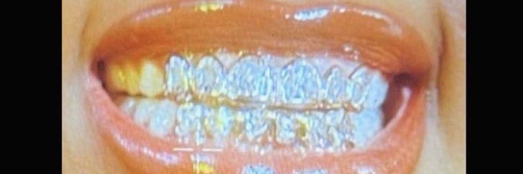 🍭🍭🍭🍭 banner