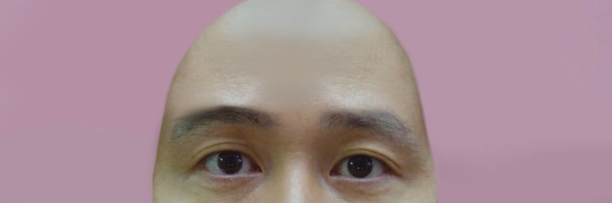 Bald Gihun's banner
