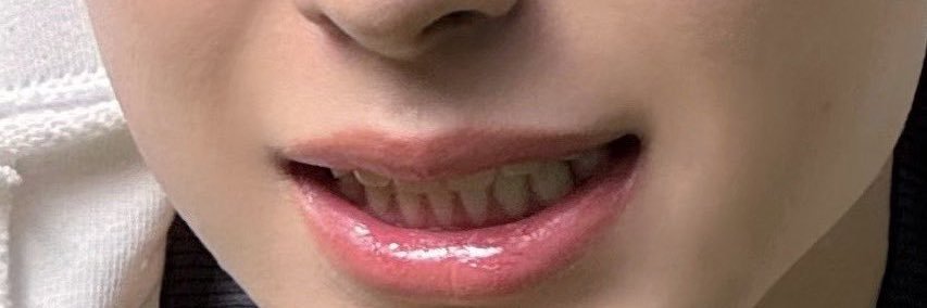 요요 banner