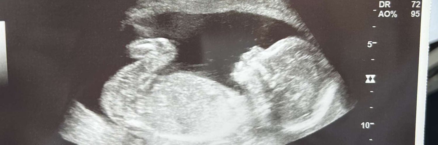 Jessicanadene's profile banner image