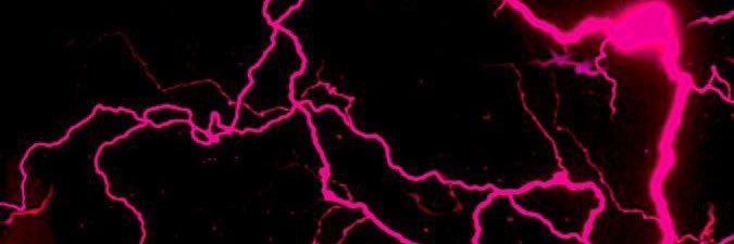 Issues 🫠 banner