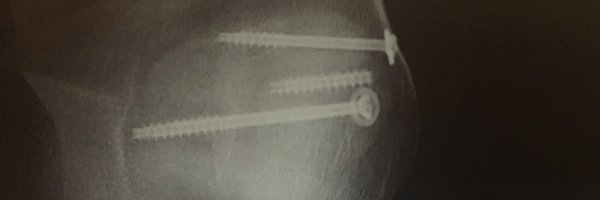 redmarker Profile Banner