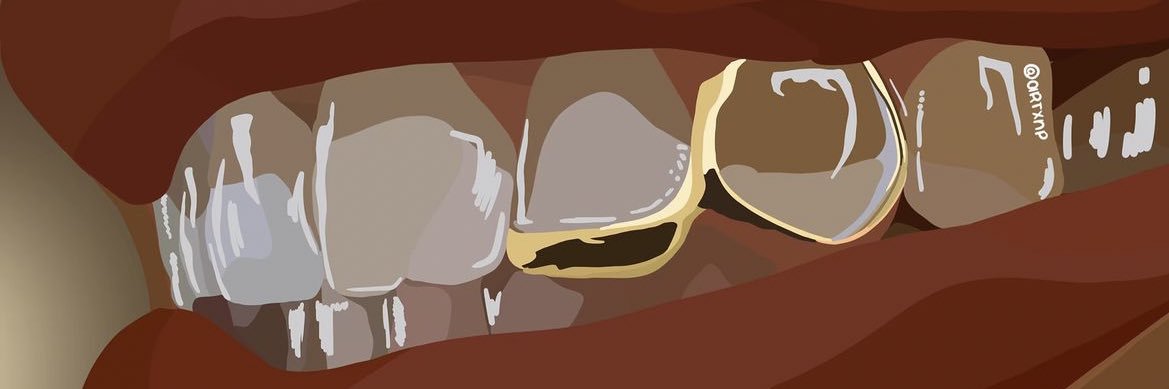 its not on a keychain… banner