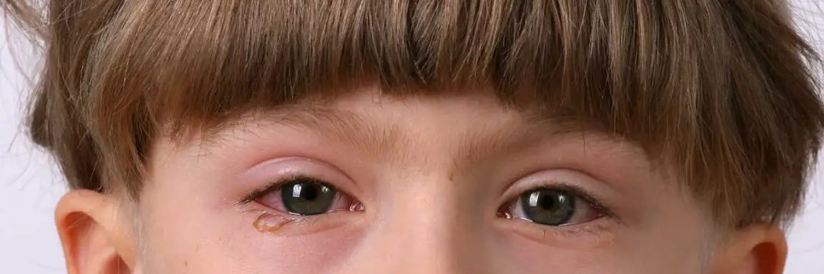 Pinkeye Peter's banner