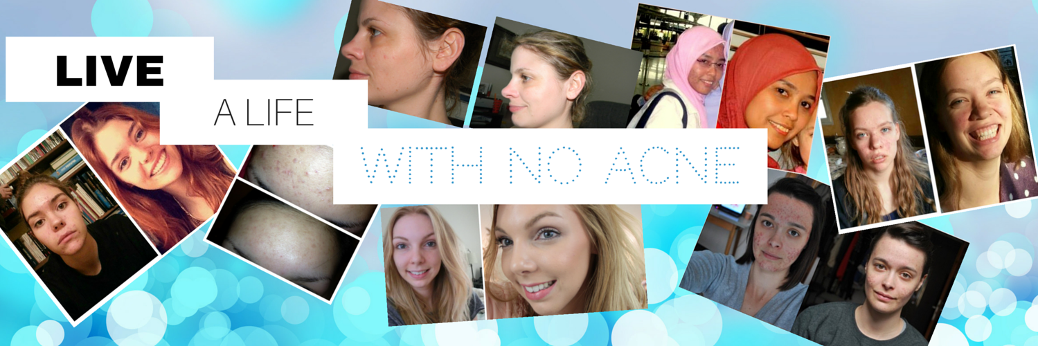 acnease's profile banner image