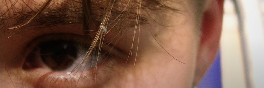 lextospirosis's profile banner image
