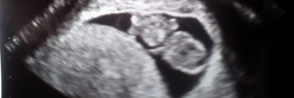 PlsLetMeExplain's profile banner image