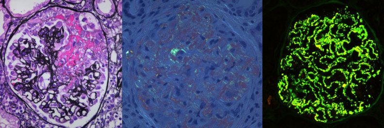 日本腎病理協会【公式】 Japanese Renal Pathology Society -JRPS banner