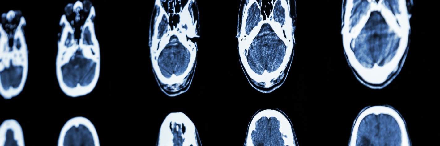 Prof Chris Bladin banner