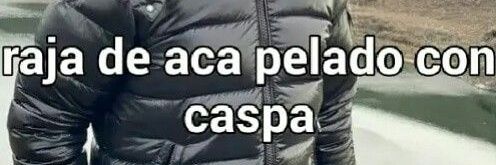 peladoconcaspa's profile banner image