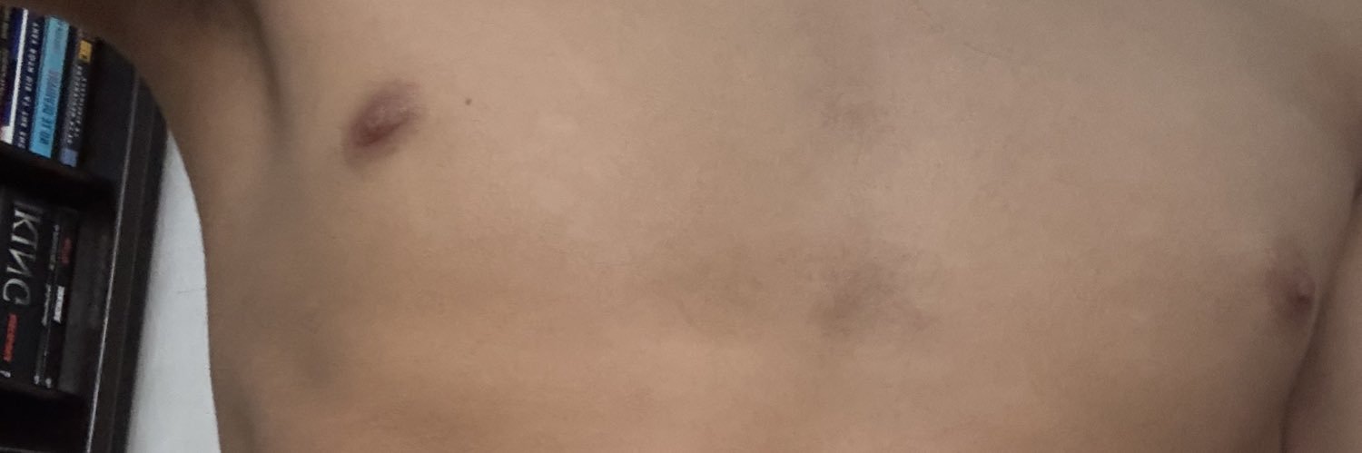 D banner