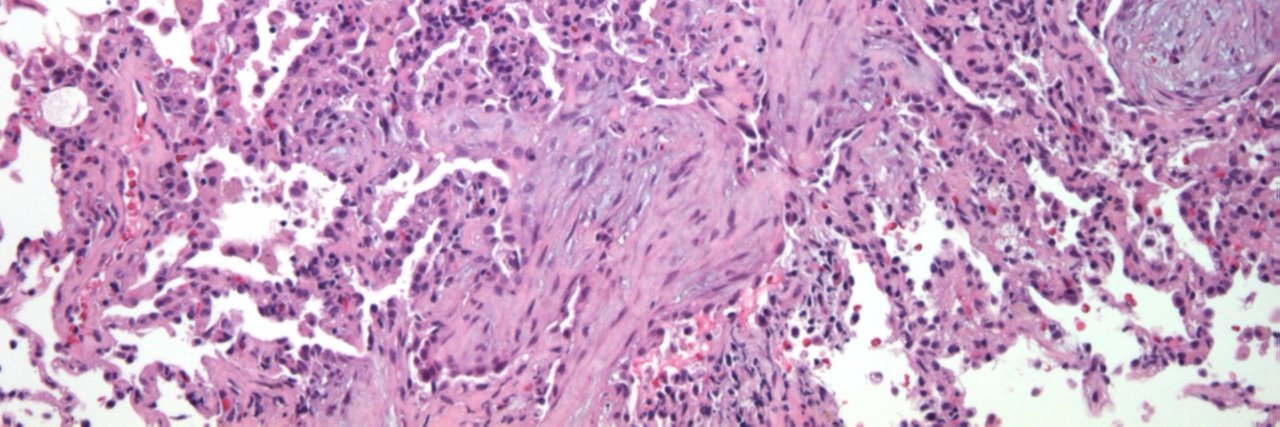 Timothy Craig Allen, MD, JD, FCAP banner