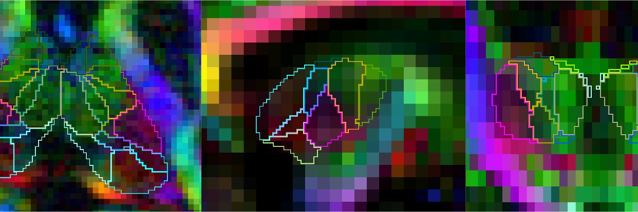 Henry Tregidgo banner