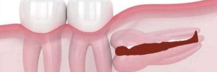 아잉슈타잉 banner