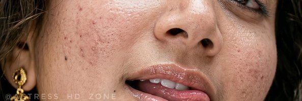 A banner