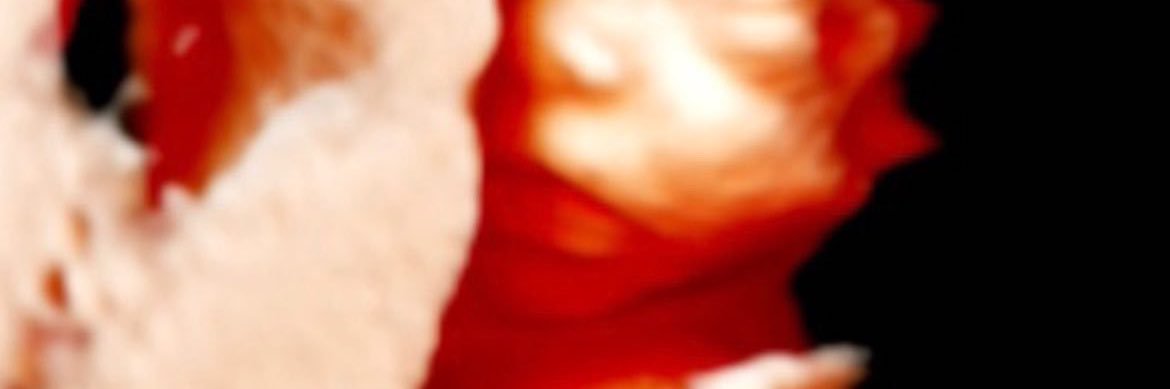 laislaleme's profile banner image