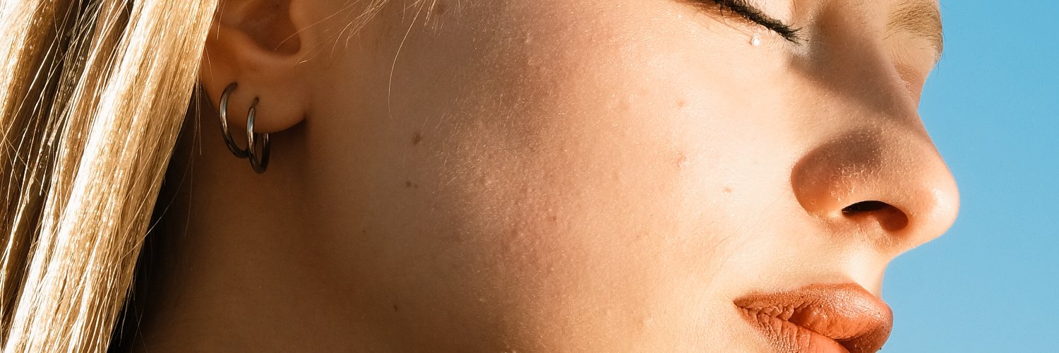 Sarecor Nomarel banner