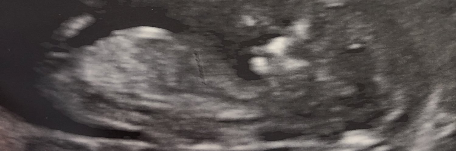 Nursey25's profile banner image