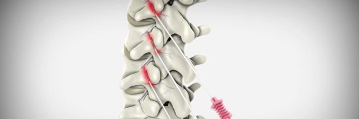 Jason Erickson, DO, MSPT banner