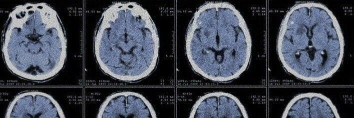 Tae ｡𖦹°‧ 🩻 banner