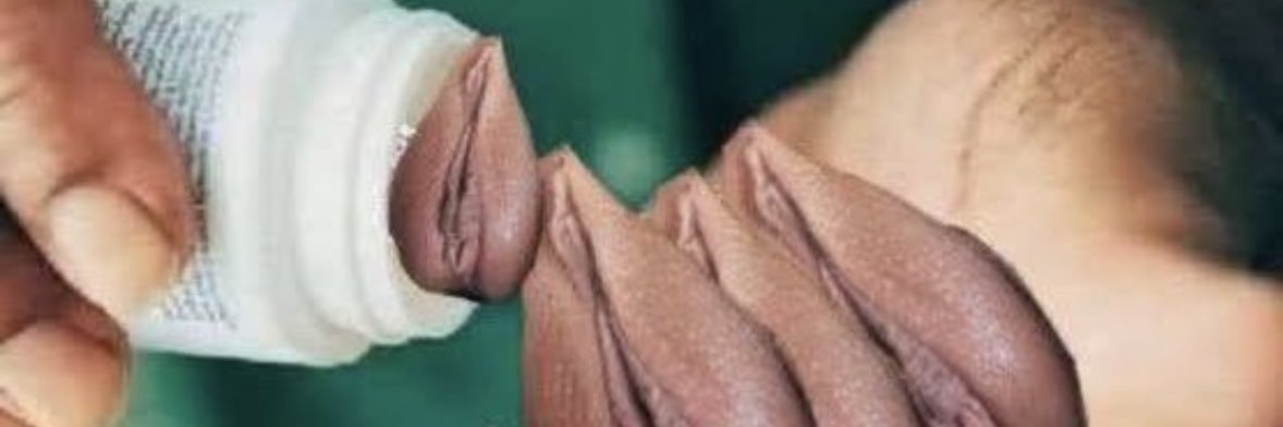 shortthickness banner