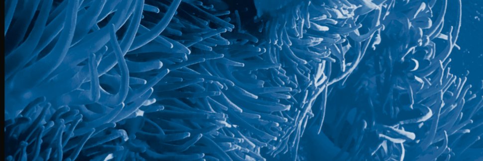 Runar Magnusson banner