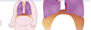 SIDS-CDF_hypothesis_P Siren banner