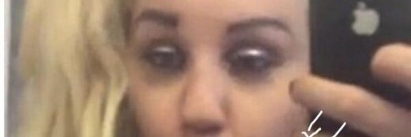 Depakote Profile Banner