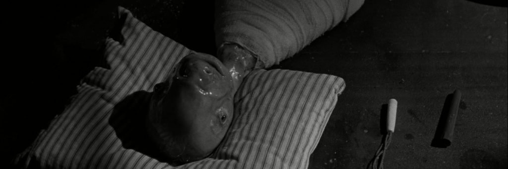 Carl Johnson Teratoma banner