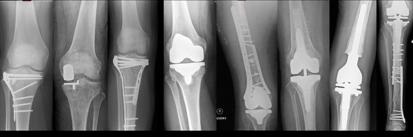 EdinburghKnee Profile Banner