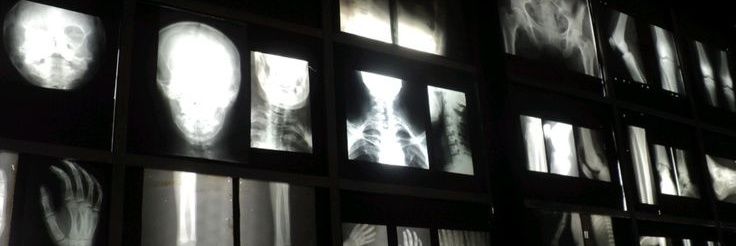 Bruno Stokowski banner