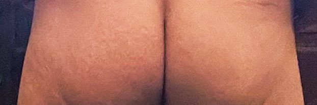 Naked Man banner