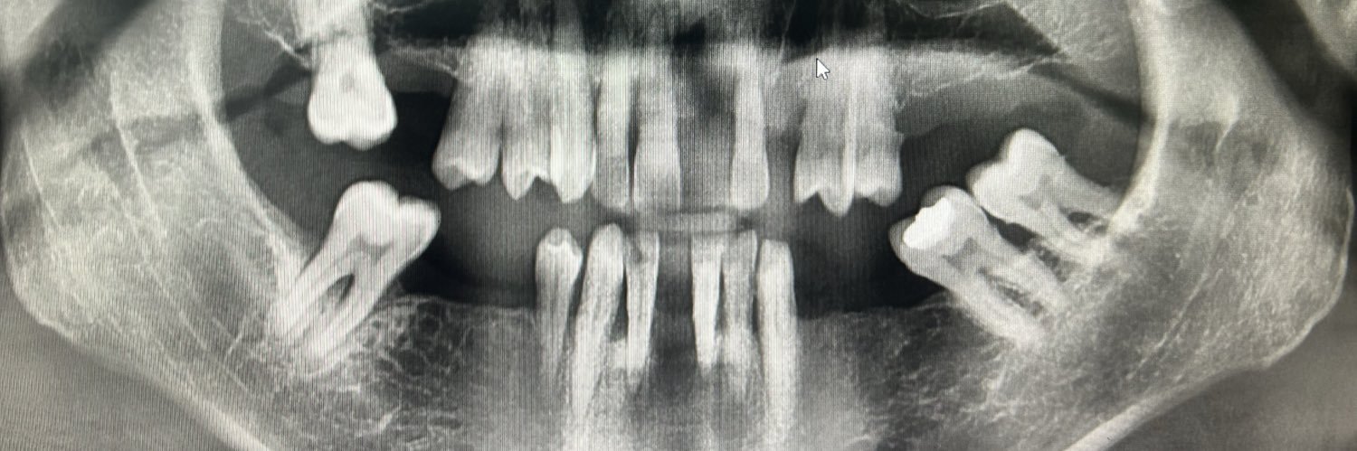 Toothlander banner