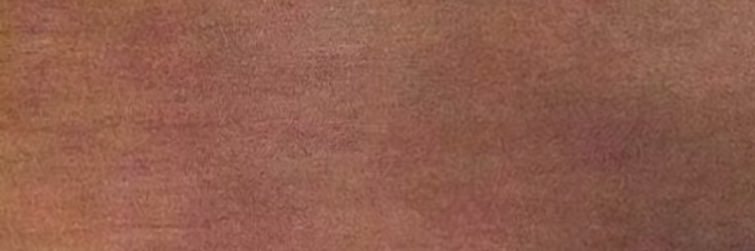 X banner