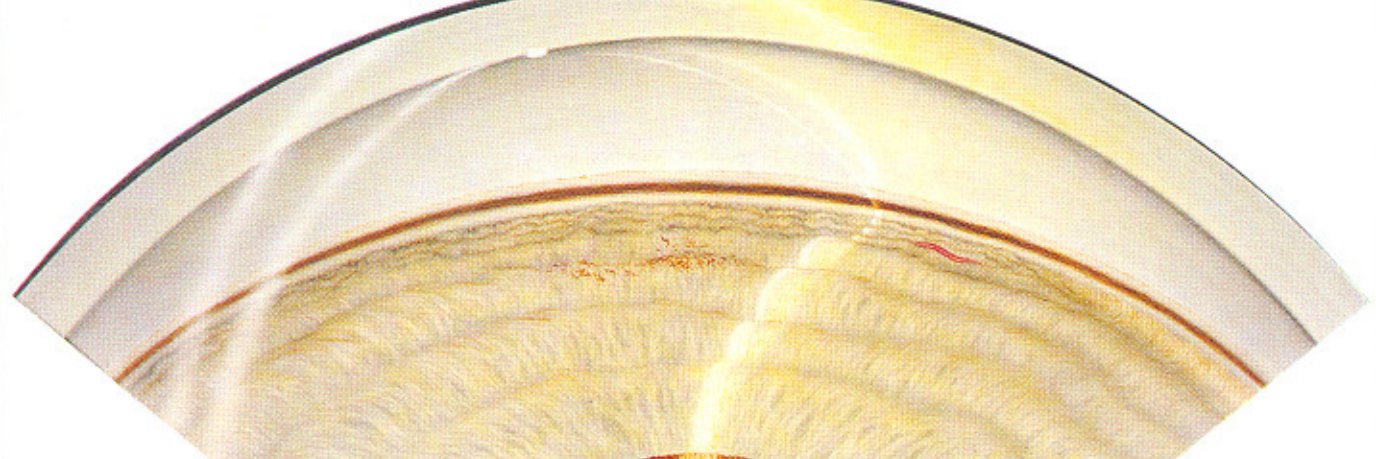 JYEyeMD's profile banner image