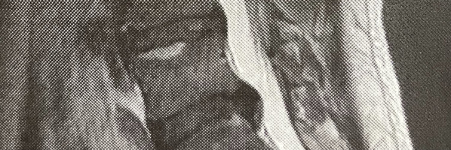 herniateddisk35's profile banner image