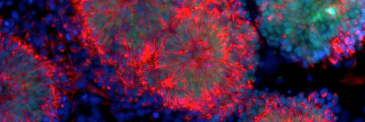 Susan Solomon banner