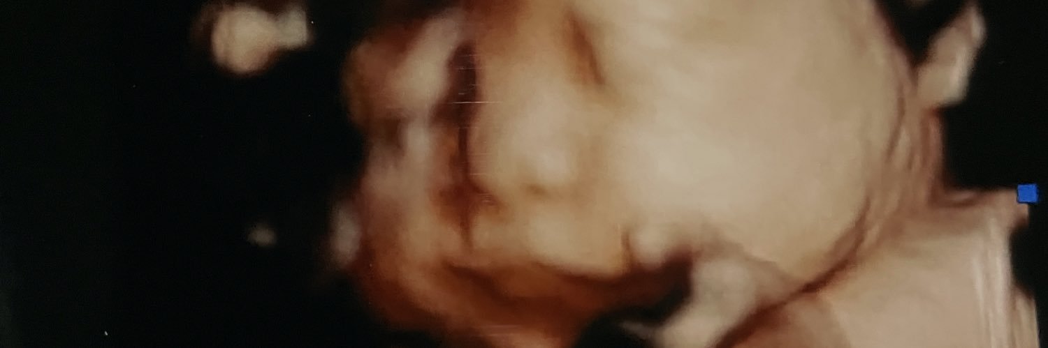 agngmlr's profile banner image
