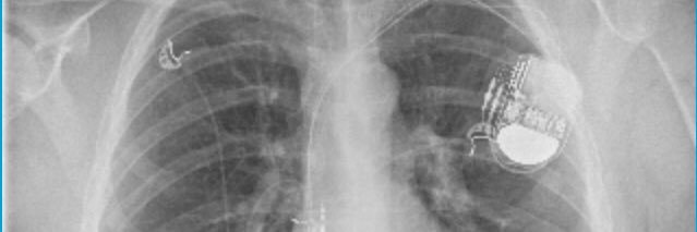 Marc De Weerdt banner