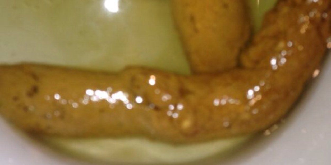 shitey_arse's profile banner image