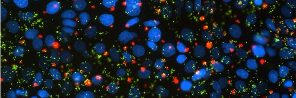 allisonlhaas Profile Banner