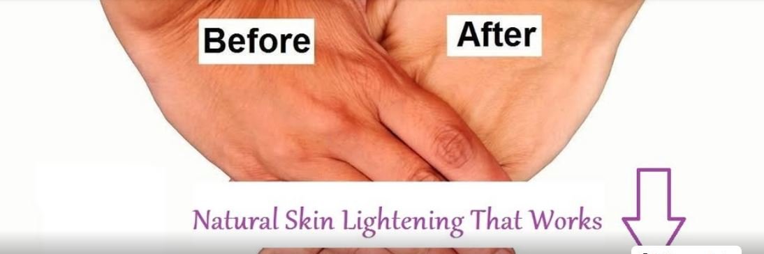 NaturalSkinNZ's profile banner image