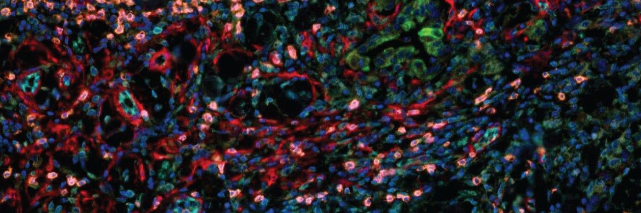 Kalluri Lab's banner