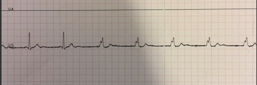 Abby Salvadore banner