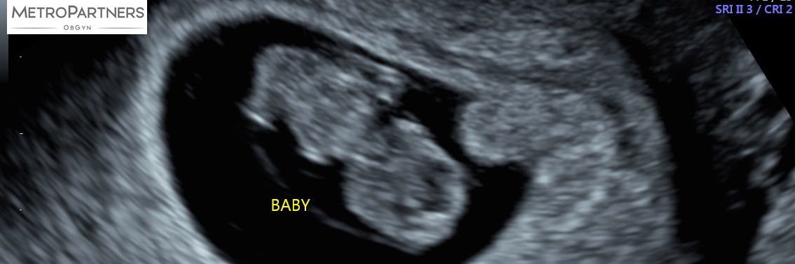 Ericjj20's profile banner image