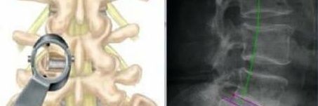 Isaí G's banner