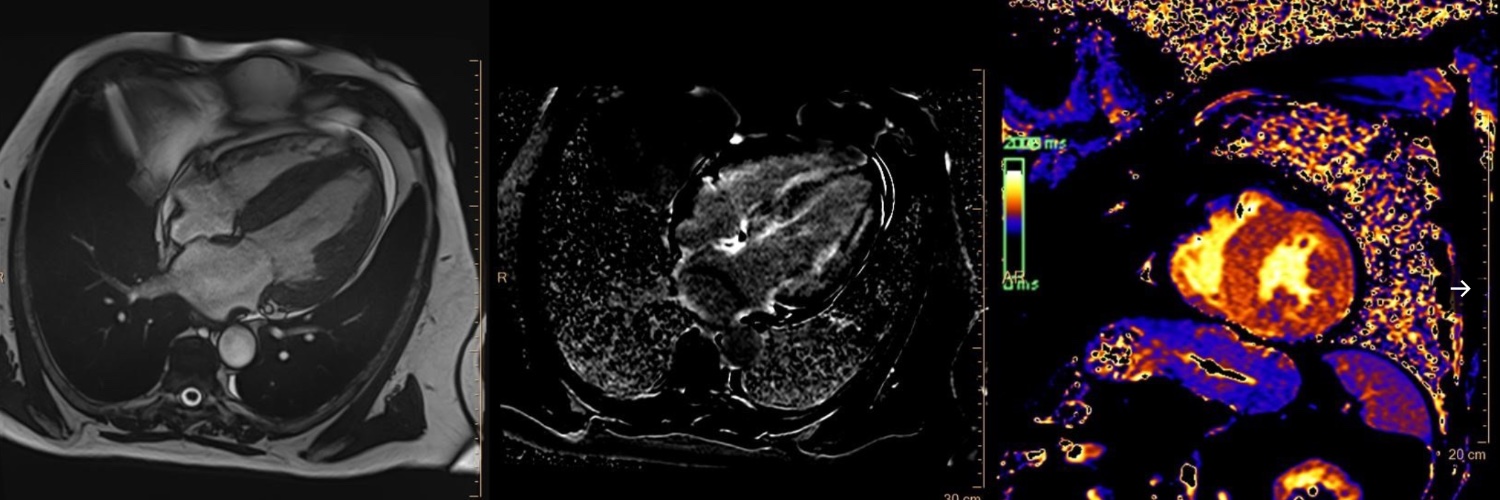 Federico Marchini banner