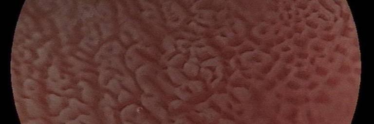 Portsmouth Endoscopy banner