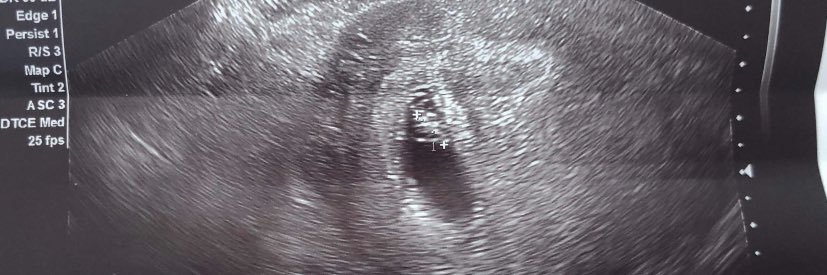 ErvinSunga's profile banner image