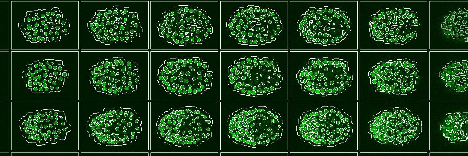 Coleman Broaddus banner